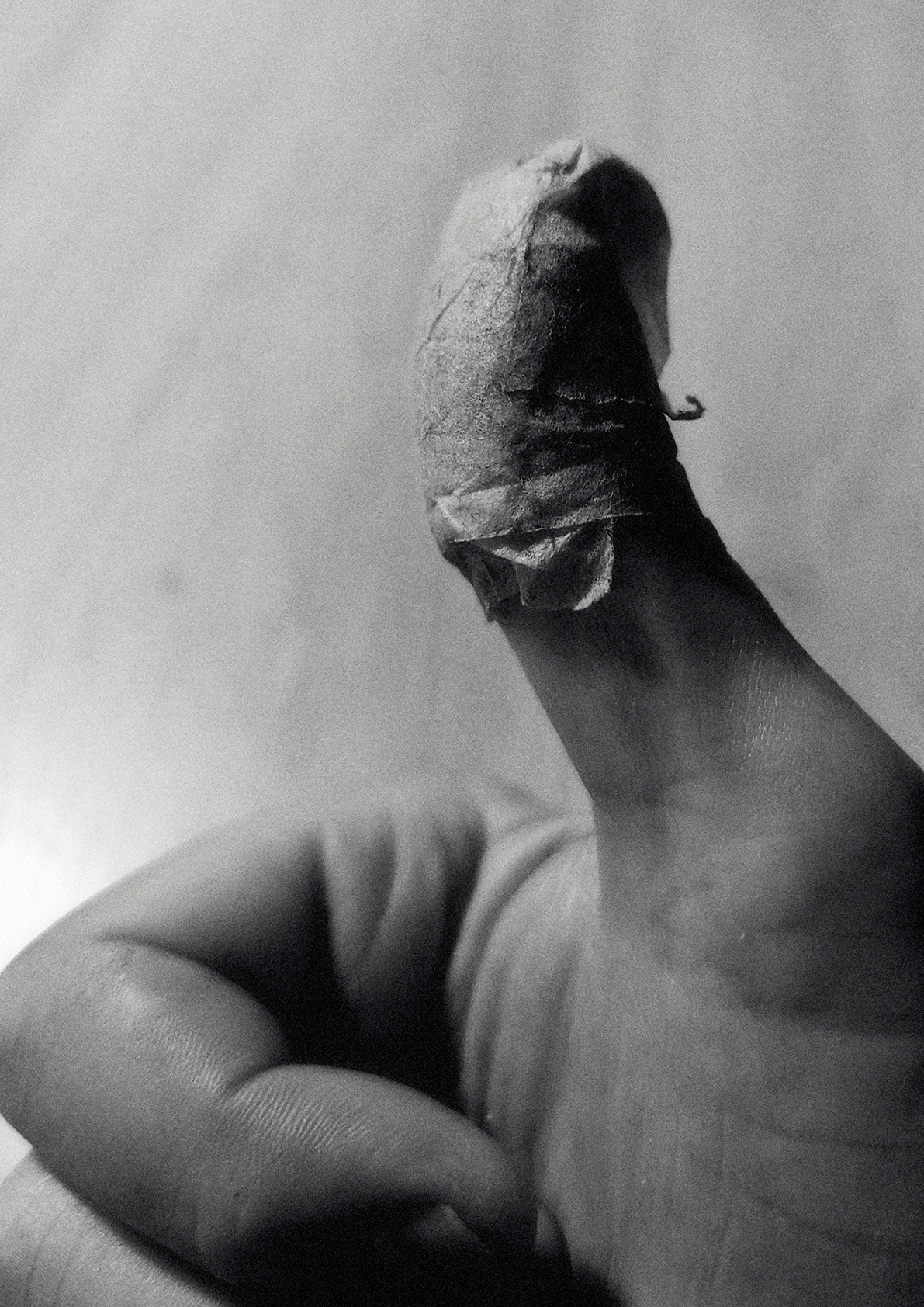 Black and white close-up of weathered hands cupping protectively around a small bandaged finger, conveying care and healing.